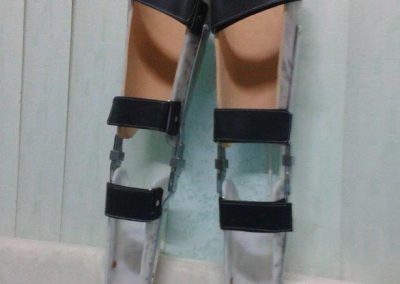 HKAFO جهاز شلل فوق الركبة مع مفصل الحوض و الركبة